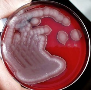 Colonie di Bacillus Cereus su Agar sangue